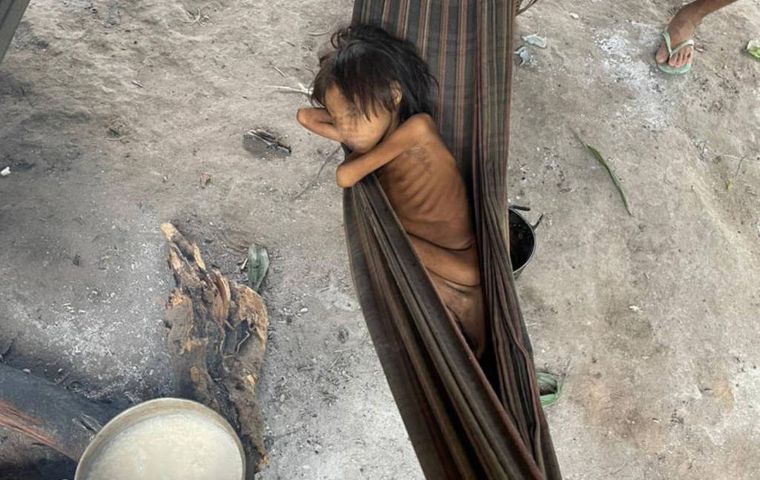 Imágenes de niños con bajo peso afectados por desnutrición y enfermedades como la malaria se mostraron en el informe de TV Globo el domingo.