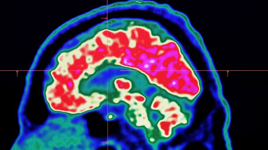 La neurotecnología no debe tratar a los humanos como ratones