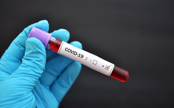 WC ve una disminución constante en las infecciones y hospitalizaciones por COVID-19