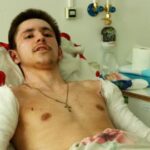 Oleksiy Paradovsky está siendo tratado por sus heridas por explosión en un hospital en Odesa.