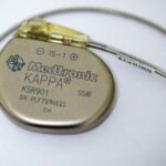 Implantes cardíacos reutilizados de muertos en Rumania: fiscales