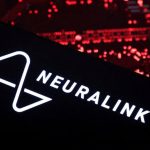 Neurocirujanos canadienses buscan seis pacientes para el estudio cerebral Neuralink de Musk