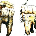 La carne no estaba en el menú del ancestro humano Australopithecus